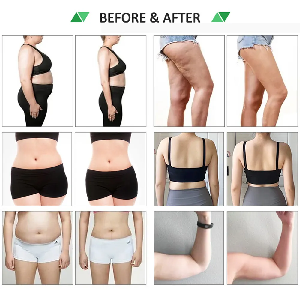 professional 532nm cold laser body slimming & cellulite reduction machine