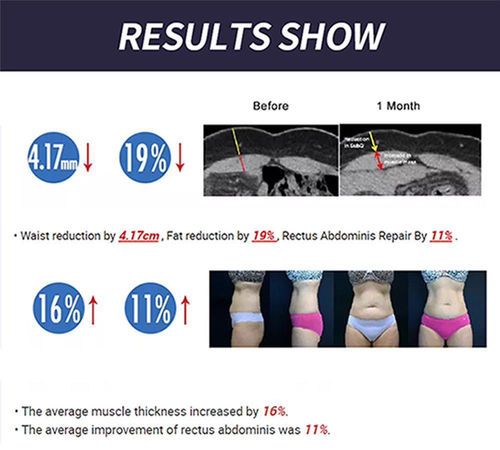 best selling 4 handles ems body slimming & muscle building equipment