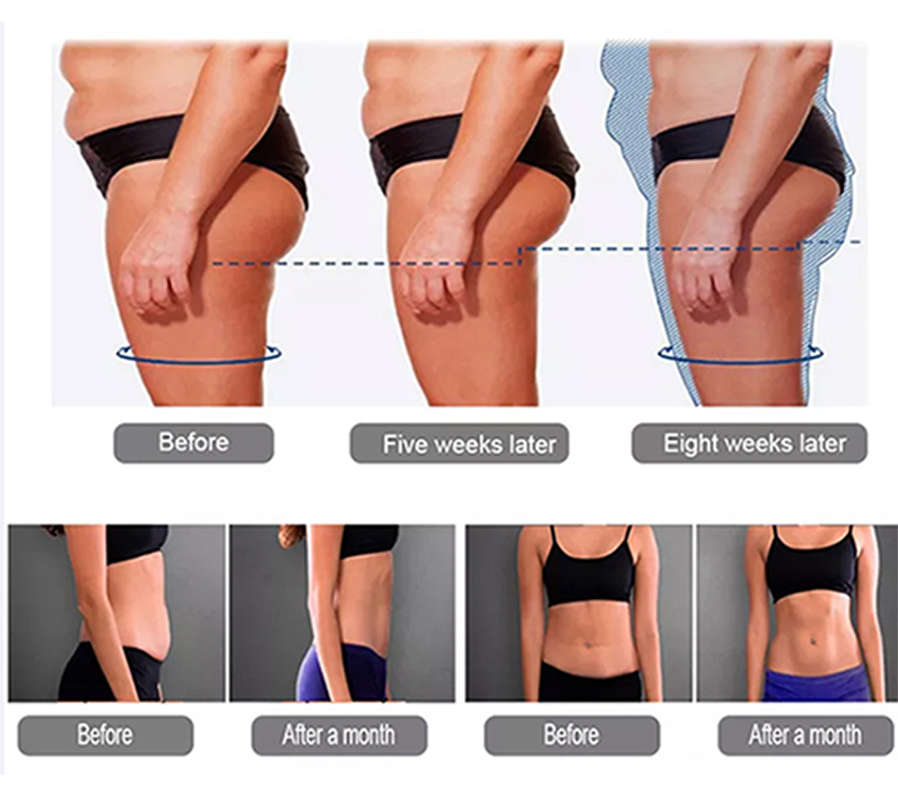 best selling 4 handles ems body slimming & muscle building equipment