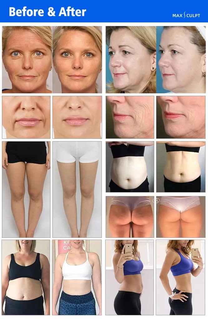 professional 4 in 1 vacuum roller rf body slimming & cellulite reduction machine