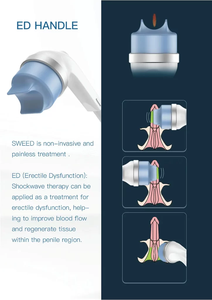 professional focus shockwave therapy machine for physiotherapy & ed (jb sw7)