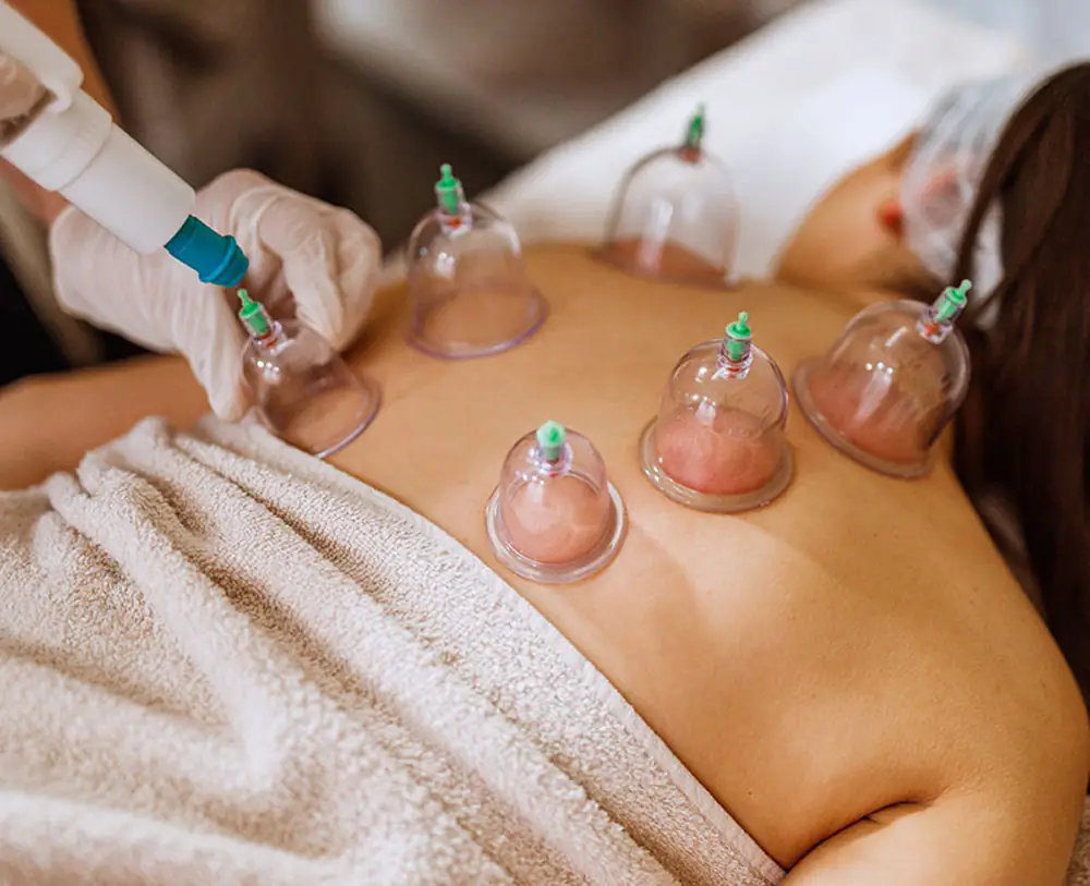 professional plastic hijama cupping therapy sets for dry & wet cupping