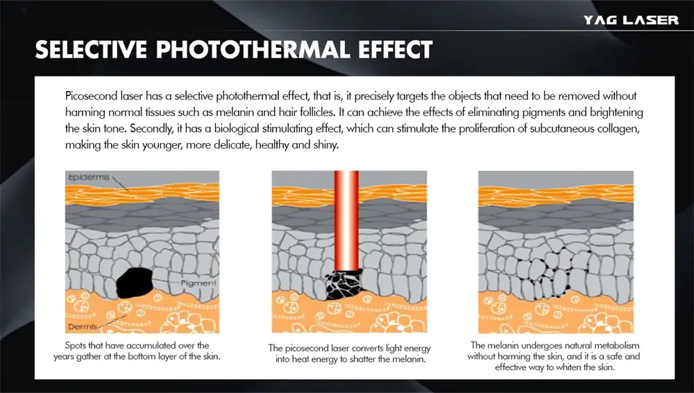professional 2000w nd:yag picosecond laser machine for tattoo removal & pigmentation