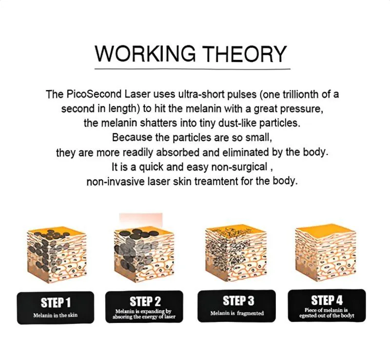 professional picosecond q switch nd: yag laser tattoo removal machine