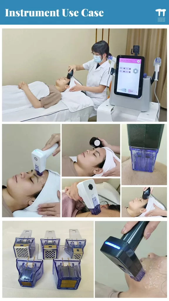 professional portable fractional rf microneedling beauty machine (jb fr01)