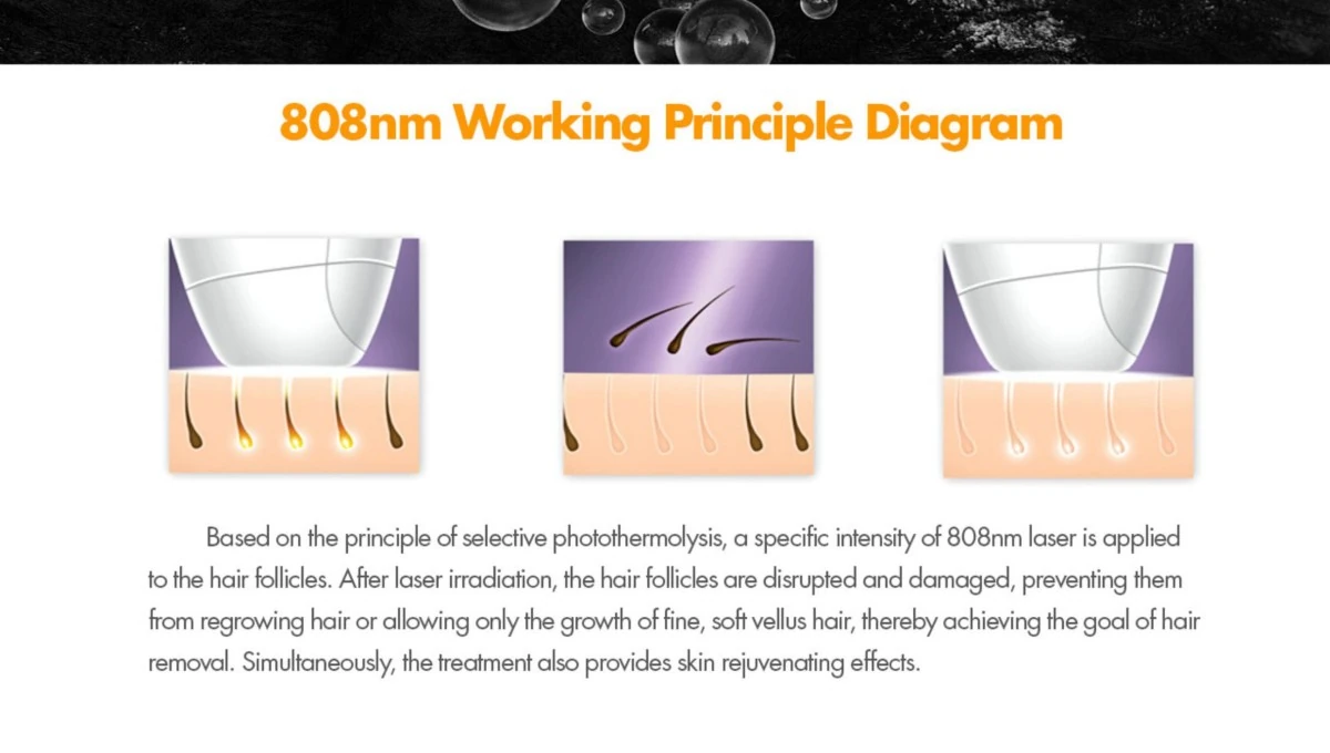 professional 1200w 808nm diode laser hair removal machine
