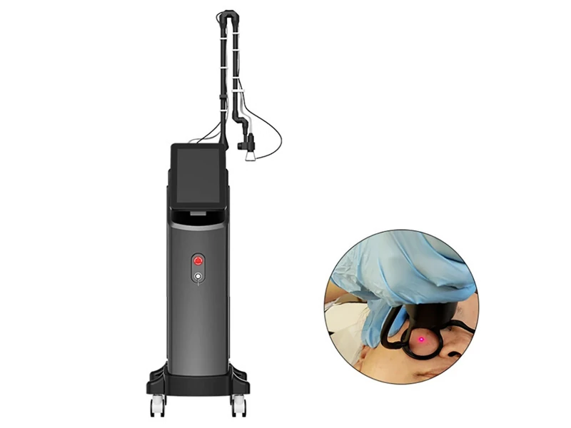 Why Professional 60W CO2 Fractional Laser Machines Are Widely Used for Skin Resurfacing and Intimate Care