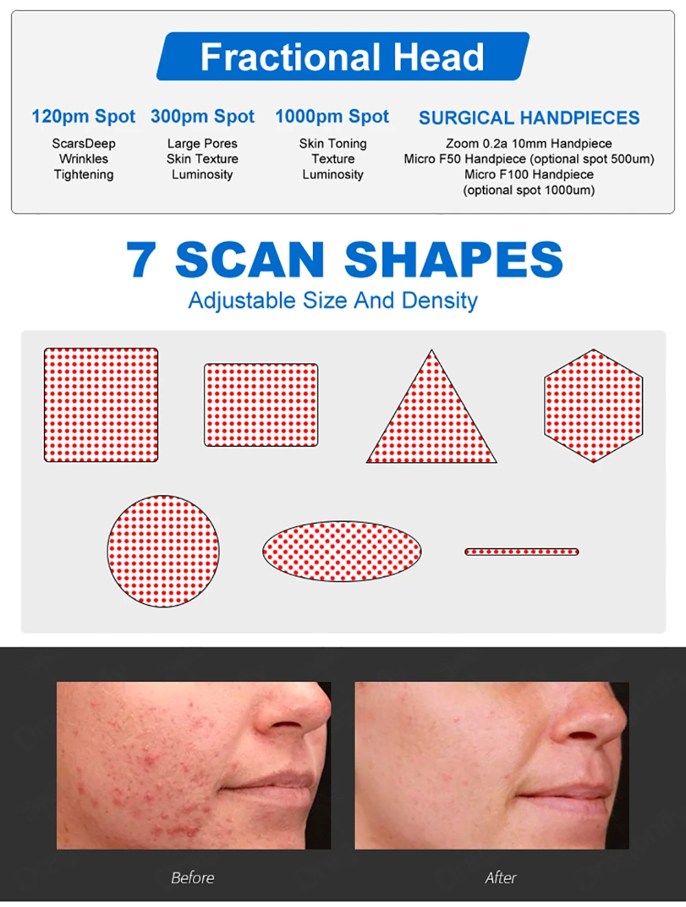 professional 60w fractional co2 laser machine for skin resurfacing & rejuvenation