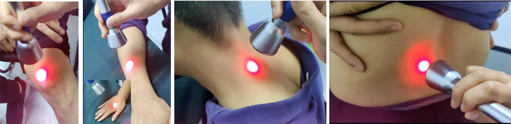 professional 40w tri wavelength high intensity laser therapy machine (810+980+1064nm)